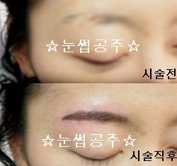 눈썹공주 이미지